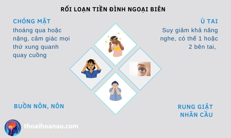 Biểu Hiện Rối Loạn Tiền Đình Ngoại Biên