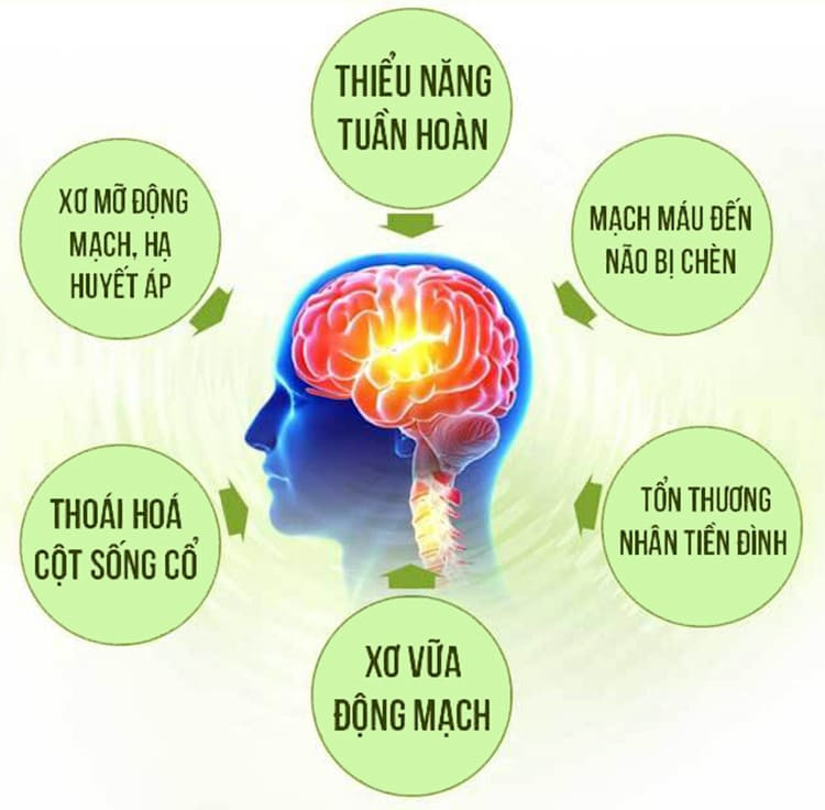 #7 Nguyên nhân rối loạn tiền đình đừng chủ quan kẻo hối hận