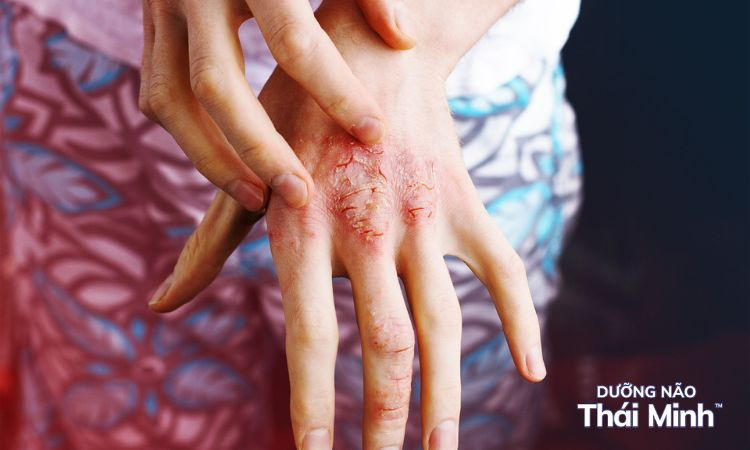 Điều hòa đồng hồ sinh học và giấc ngủ bằng Vitamin D