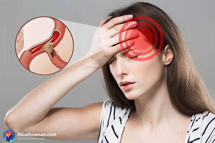 3 bài thuốc điều trị thiếu máu não bằng Đông y cực hiệu quả!