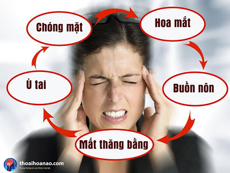 Rối loạn tiền đình là gì?