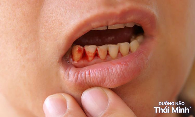 Tăng cường sức khỏe và giấc ngủ nhờ vitamin C