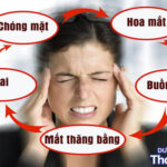 [Giải đáp] Rối loạn tiền đình có được gội đầu không?