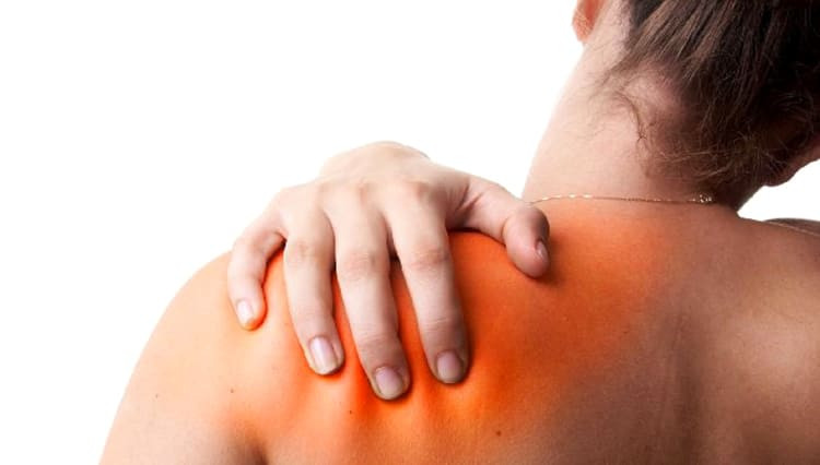 Viêm khớp vai cũng có thể là nguyên nhân gây đau đầu vùng sau gáy